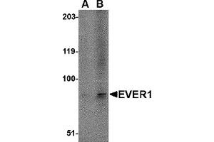 Western Blotting (WB) image for anti-Transmembrane Channel-Like 6 (TMC6) (N-Term) antibody (ABIN1031375) (TMC6 Antikörper  (N-Term))