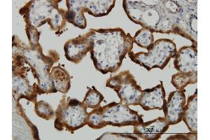 Immunoperoxidase of monoclonal antibody to TGM2 on formalin-fixed paraffin-embedded human placenta. (Transglutaminase 2 Antikörper  (AA 1-120))