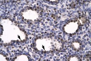 Image no. 1 for anti-High Mobility Group Box 2 (HMGB2) (C-Term) antibody (ABIN6735776) (HMGB2 Antikörper  (C-Term))