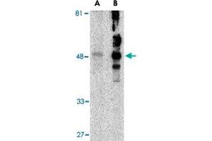 Western blot analysis of HAVCR1 in human uterus tissue lysate with HAVCR1 polyclonal antibody  at (A) 1 and (B) 2 ug/mL . (HAVCR1 Antikörper  (N-Term))