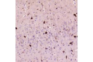 IHC analysis of Cystatin C using anti-Cystatin C antibody (ABIN5692829). (CST3 Antikörper  (AA 31-146))