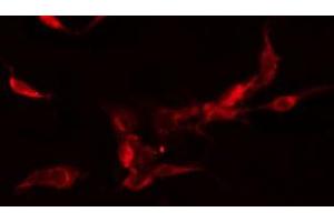 ABIN6278463 staining  Hela cells by IF/ICC. (FLT3 Antikörper  (C-Term))