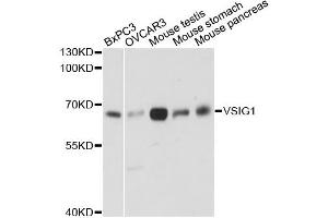 Western blot analysis of extracts of various cell lines, using VSIG1 antibody (ABIN6292332) at 1:3000 dilution. (VSIG1 Antikörper)