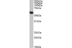 Biotinylated ABIN5539616 (1µg/ml) staining of Human Liver lysate (35µg protein in RIPA buffer), exactly mirroring its parental non-biotinylated product. (FTCD Antikörper  (N-Term) (Biotin))