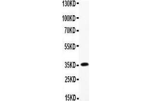 Anti-CNTF Picoband antibody,  All lanes: Anti-CNTF at 0. (CNTF Antikörper  (AA 2-198))