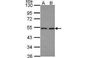 CLP1 Antikörper  (Center)