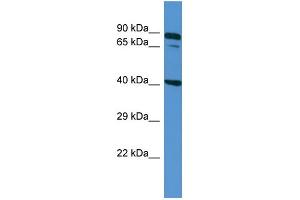 Host: Rabbit Target Name: ZDHHC11B Sample Type: NCI-H226 Whole cell lysates Antibody Dilution: 1. (ZDHHC11B Antikörper  (N-Term))