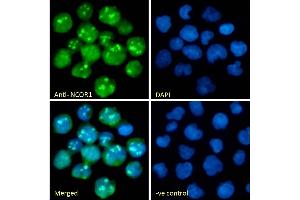 (ABIN7505820) Immunofluorescence analysis of paraformaldehyde fixed Jurkat cells, permeabilized with 0. (NCOR1 Antikörper)