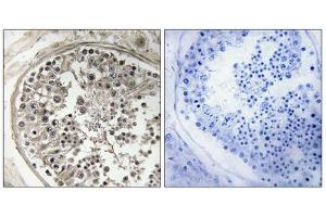 Immunohistochemistry analysis of paraffin-embedded human testis tissue using MRPS5 antibody.