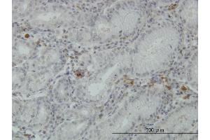 Immunoperoxidase of monoclonal antibody to FGL2 on formalin-fixed paraffin-embedded human stomach. (FGL2 Antikörper  (AA 24-123))