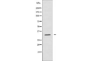Western blot analysis of extracts from HepG2 cells using RPL5 antibody. (RPL7 Antikörper  (C-Term))
