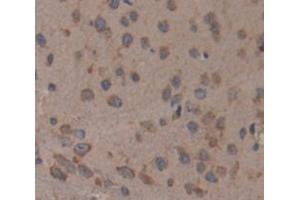 Immunohistochemistry (IHC) image for anti-Cadherin EGF LAG Seven Pass G-Type Receptor 2 (CELSR2) (AA 2589-2849) antibody (ABIN5013263)