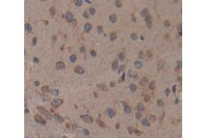 Used in DAB staining on fromalin fixed paraffin- embedded Kidney tissue (CELSR2 Antikörper  (AA 2589-2849))