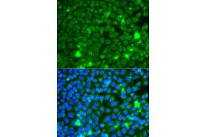 Immunofluorescence analysis of  cells using GB antibody (ABIN6131369, ABIN6140990, ABIN6140991 and ABIN6223796). (GBA3 Antikörper  (AA 1-162))