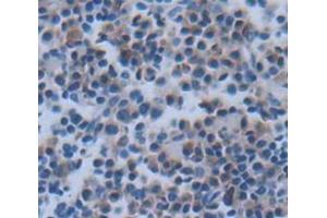 IHC-P analysis of Rat Tissue, with DAB staining. (CXCL9 Antikörper  (AA 22-125))