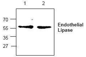 Image no. 1 for anti-Lipase, Endothelial (LIPG) antibody (ABIN127288) (LIPG Antikörper)