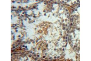 Used in DAB staining on fromalin fixed paraffin-embedded Testis tissue (WFDC2 Antikörper  (AA 30-124))