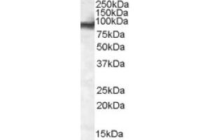 Image no. 1 for anti-Ewing Sarcoma Breakpoint Region 1 (EWSR1) (Internal Region) antibody (ABIN375098) (EWSR1 Antikörper  (Internal Region))