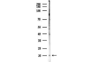 Western blot analysis of lysates from PC12 cells(starvation 24h treatment), using INSL4 Antibody at 1/1000 dilution.