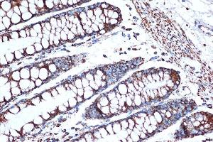 Immunohistochemistry of paraffin-embedded human colon using HSPE1/HSP10/HSPE1/HSP10/CPN10 Rabbit mAb (ABIN7267567) at dilution of 1:100 (40x lens). (HSPE1 Antikörper)