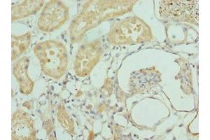 Immunohistochemistry of paraffin-embedded human kidney tissue using ABIN7156394 at dilution of 1:100 (INTS1 Antikörper  (AA 451-710))