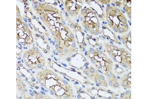 Immunohistochemistry of paraffin-embedded Mouse kidney using AIP Polyclonal Antibody at dilution of 1:100 (40x lens). (AIP Antikörper)