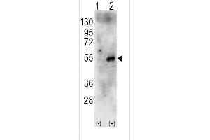Western blot analysis of RPS6KB2 (arrow) using rabbit polyclonal RPS6KB2 Antibody (Center) (R). (RPS6KB2 Antikörper  (AA 243-272))
