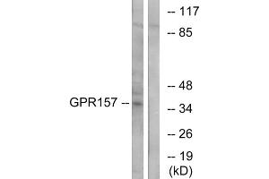 Western blot analysis of extracts from NIH-3T3 cells, using GPR157 antibody. (GPR157 Antikörper  (Internal Region))