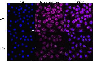 Immunocytochemical staining of HeLa cells using Prolyl endopeptidase like antibody (ABIN7799923), 1:1,000), Top panel: wild-type (WT), Bottom panal: Prolyl endopeptidase like shRNA knockdown (KD). (Rekombinanter PREPL Antikörper)