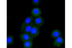 Immunofluorescence analysis of CRC cells using BAK1 antibody (ABIN5996915). (BAK1 Antikörper)