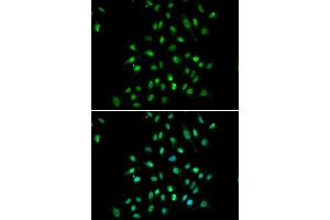 Immunofluorescence analysis of  cells using CXXC1 antibody (ABIN6130102, ABIN6139292, ABIN6139295 and ABIN6221504). (CXXC1 Antikörper  (AA 1-210))