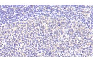 Detection of IL6 in Human Lymph node Tissue using Polyclonal Antibody to Interleukin 6 (IL6) (IL-6 Antikörper  (AA 29-212))