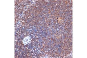 Immunohistochemistry of paraffin-embedded rat spleen using PI3 Kinase p110 delta Rabbit mAb (ABIN7269326) at dilution of 1:100 (40x lens). (PIK3CD Antikörper)