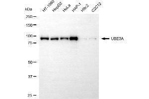 anti-Ubiquitin Protein Ligase E3A (ube3a) antibody