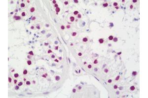Immunohistochemistry (IHC) image for anti-TAF15 RNA Polymerase II, TATA Box Binding Protein (TBP)-Associated Factor, 68kDa (TAF15) (AA 200-250) antibody (ABIN2628946)