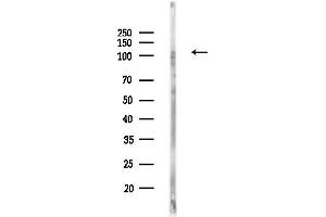 anti-Retinitis Pigmentosa GTPase Regulator (RPGR) (C-Term) antibody
