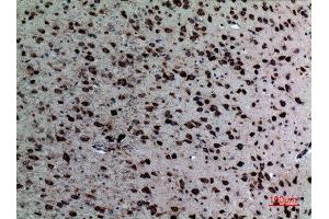 Immunohistochemistry (IHC) analysis of paraffin-embedded Mouse Brain, antibody was diluted at 1:100. (NR1H3 Antikörper  (Internal Region))