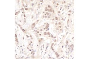 Immunohistochemistry (IHC) image for anti-Polymerase (DNA Directed), lambda (POLL) (AA 525-575) antibody (ABIN7454415) (POLL Antikörper  (AA 525-575))