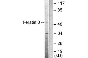 Western Blotting (WB) image for anti-Keratin 8 (KRT8) (C-Term) antibody (ABIN1848642) (KRT8 Antikörper  (C-Term))
