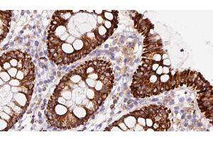 ABIN6279860 at 1/100 staining Mouse colon tissue by IHC-P. (STMN2 Antikörper  (Internal Region))
