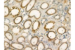 ABIN7094163 and ABIN7098207 at 1/100 staining human normal kidney tissue by IHC-P.