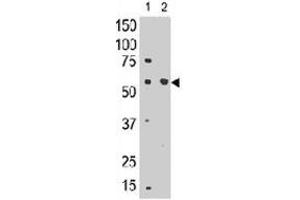 The SIGLEC8 polyclonal antibody  is used in Western blot to detect SIGLEC8 in mouse liver tissue lysate (lnae 1) and in HL-60 cell lysate (lane 2) . (SIGLEC8 Antikörper  (C-Term))