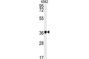 Western Blotting (WB) image for anti-Neutrophil Cytosolic Factor 4, 40kDa (NCF4) antibody (ABIN3003340) (NCF4 Antikörper)