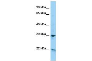 WB Suggested Anti-ADM Antibody Titration: 1.