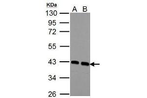 WB Image Sample (30 ug of whole cell lysate) A: NIH-3T3 B: JC 10% SDS PAGE antibody diluted at 1:1000 (CNN3 Antikörper)