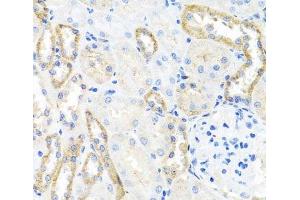 Immunohistochemistry of paraffin-embedded Rat kidney using BSND Polyclonal Antibody at dilution of 1:100 (40x lens). (BSND Antikörper)