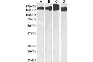 Western Blot using anti-CD171 antibody L1-14. (Rekombinanter L1CAM Antikörper)