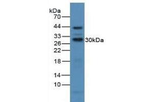 Figure. (CD25 Antikörper  (AA 22-213))