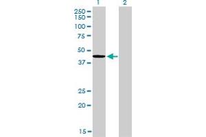 Western Blot analysis of TXNDC4 expression in transfected 293T cell line by TXNDC4 monoclonal antibody (M01A), clone 3C7. (ERP44 Antikörper  (AA 30-406))