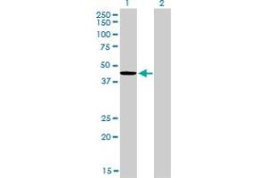 Western Blot analysis of TXNDC4 expression in transfected 293T cell line by TXNDC4 monoclonal antibody (M01A), clone 3C7.